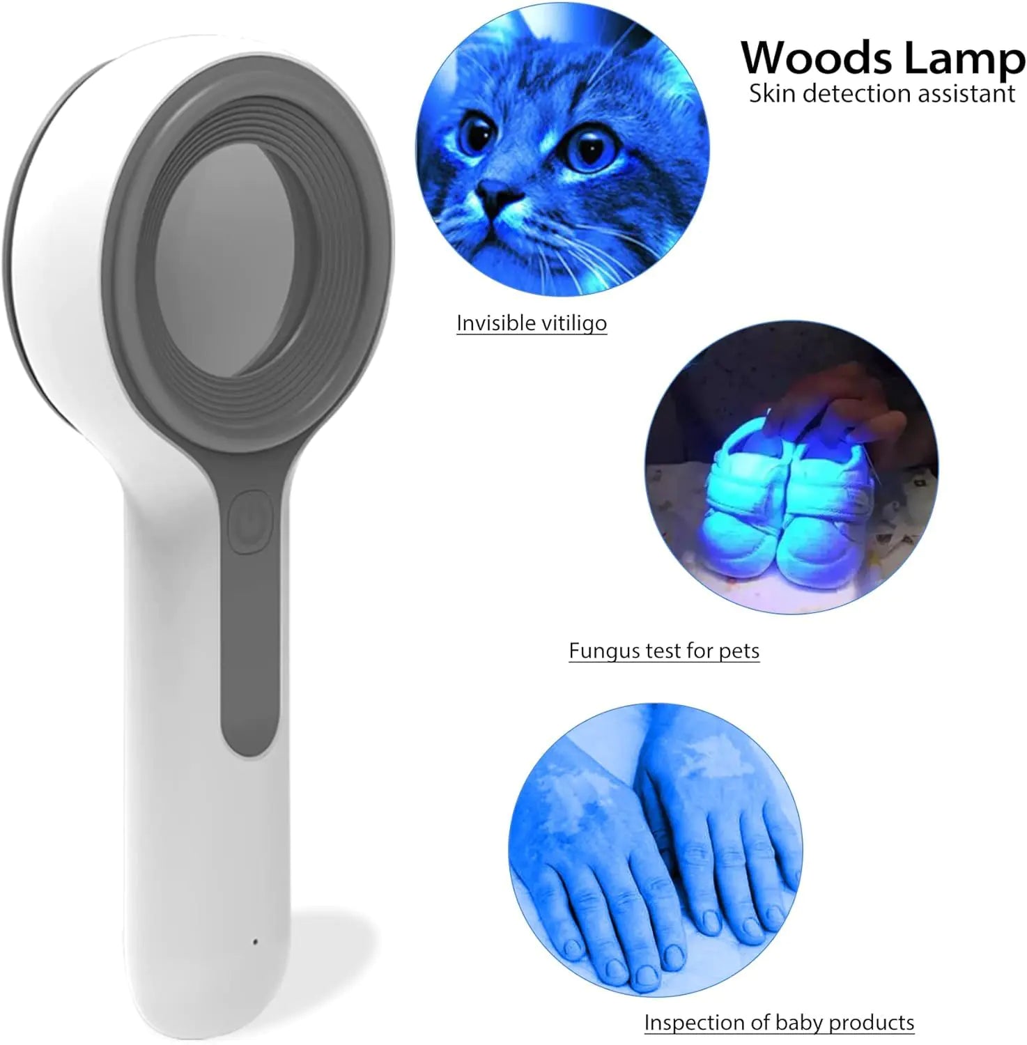 Medical Wood Lamp Skin Detection Device for Export