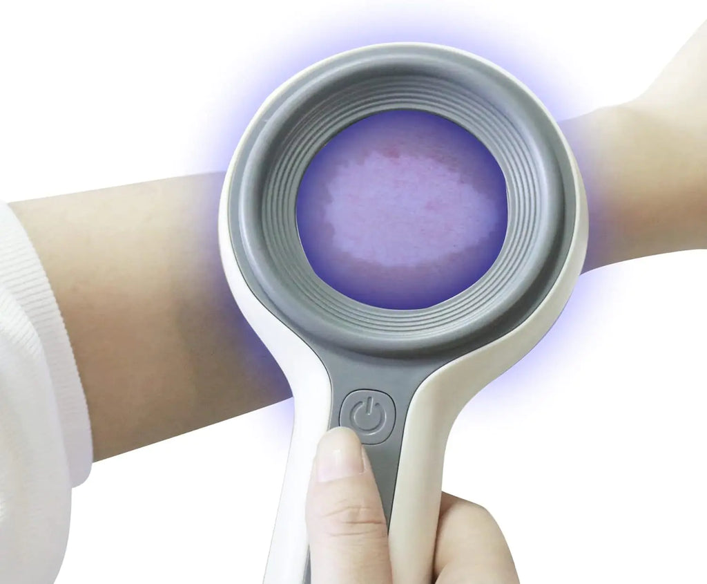 Medical Wood Lamp Skin Detection Device for Export